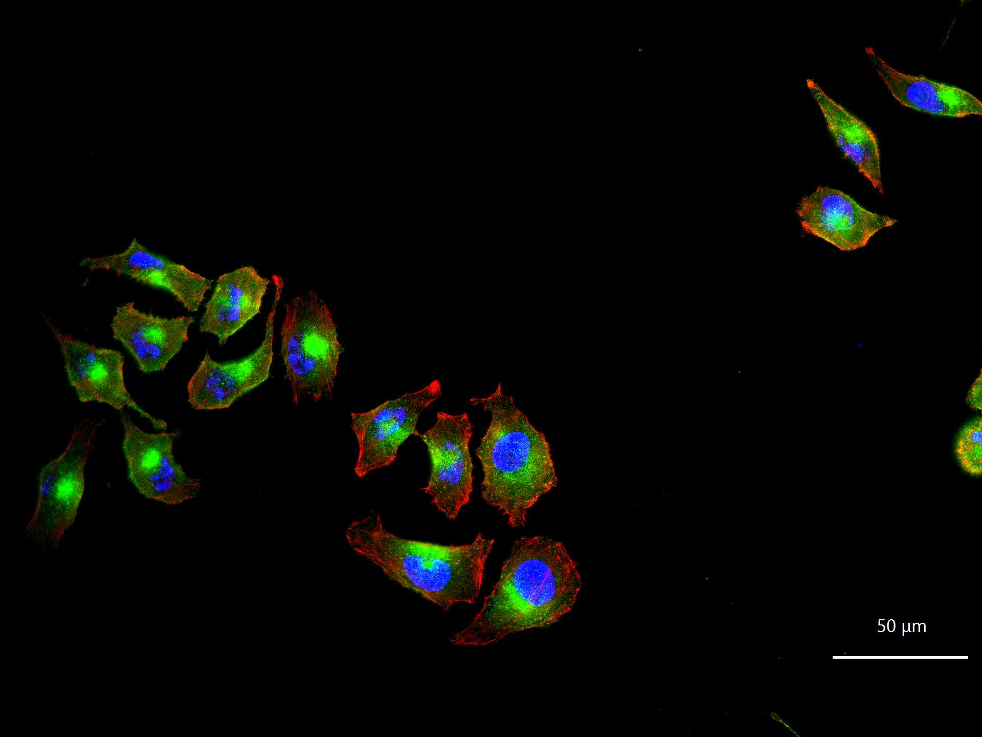 TFRC Mouse mAb (一抗) - WB,Flow-Cyt,ICC/IF | Bioss