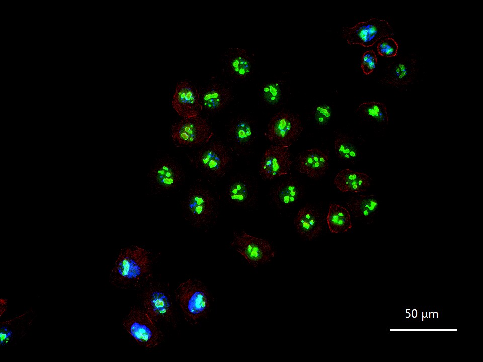 Nucleolin Recombinant Rabbit mAb (一抗) - IHC-P,IHC-F,IF,Flow-Cyt,ICC/IF | Bioss