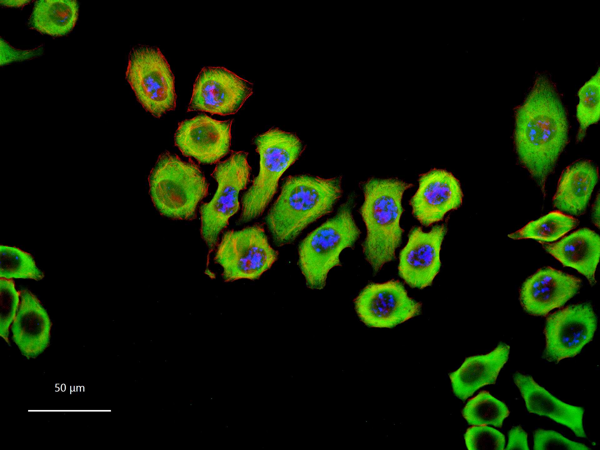 GAPDH Recombinant Rabbit mAb, Loading Control (一抗) - WB,IHC-P,IHC-F,IF,Flow-Cyt,ICC/IF | Bioss