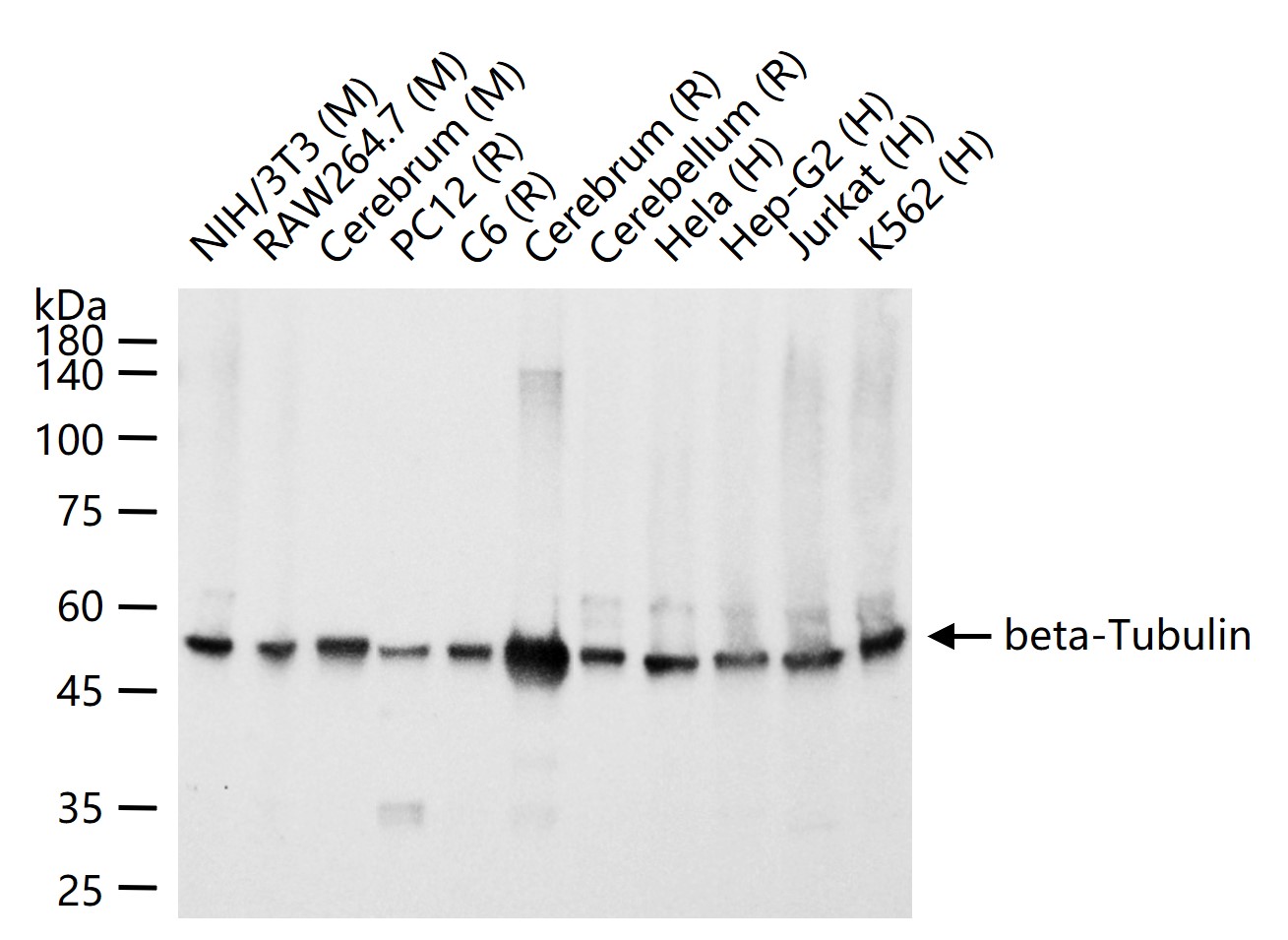 beta-Tubulin Mouse mAb, Loading Control (一抗) - WB,IHC-P,IHC-F,IF,ICC/IF | Bioss