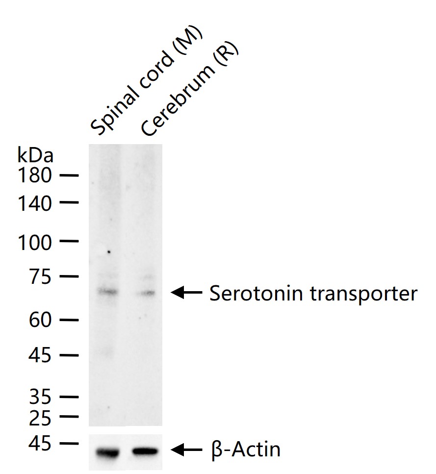 Serotonin transporter Rabbit pAb (一抗) - WB,IHC-P,IHC-F,IF,ELISA | Bioss