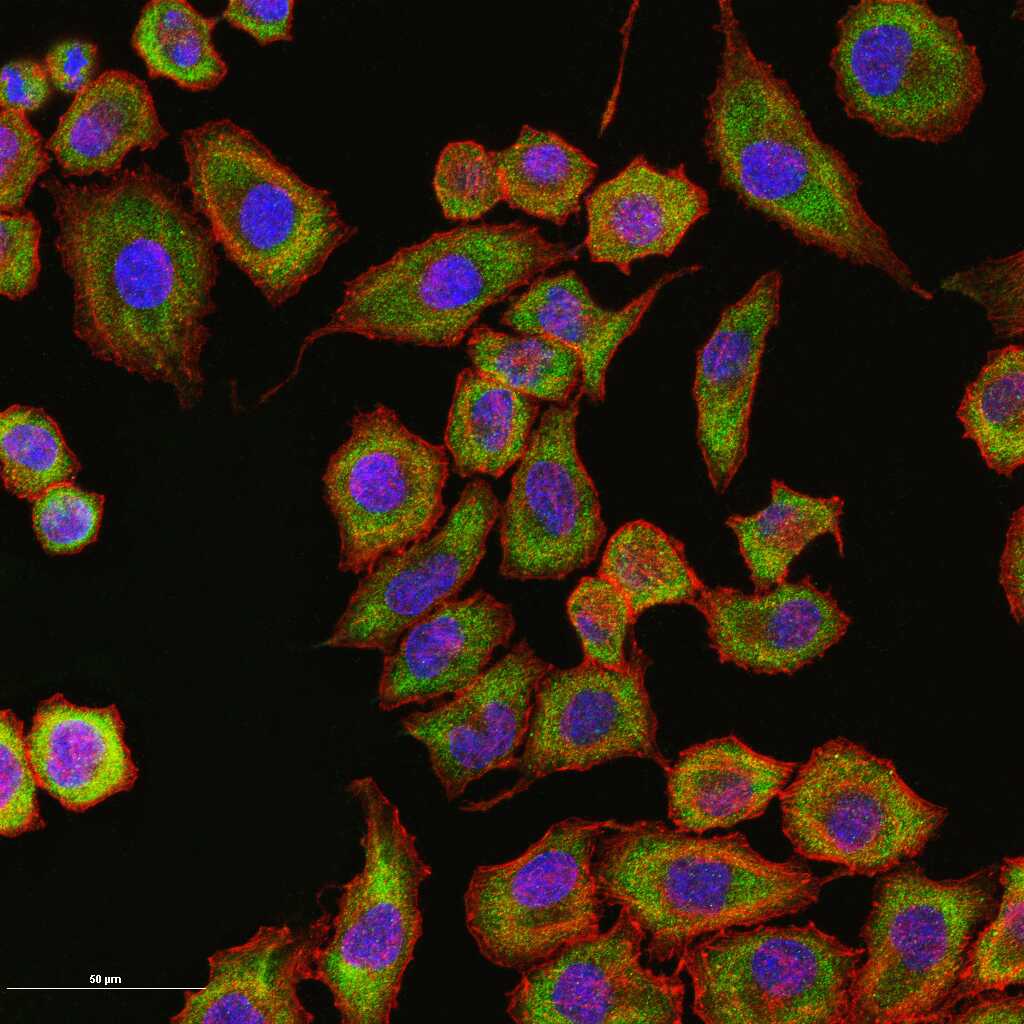 G3BP1 Recombinant Rabbit mAb (一抗) - WB,IHC-P,IHC-F,IF,Flow-Cyt,ICC/IF,IP | Bioss