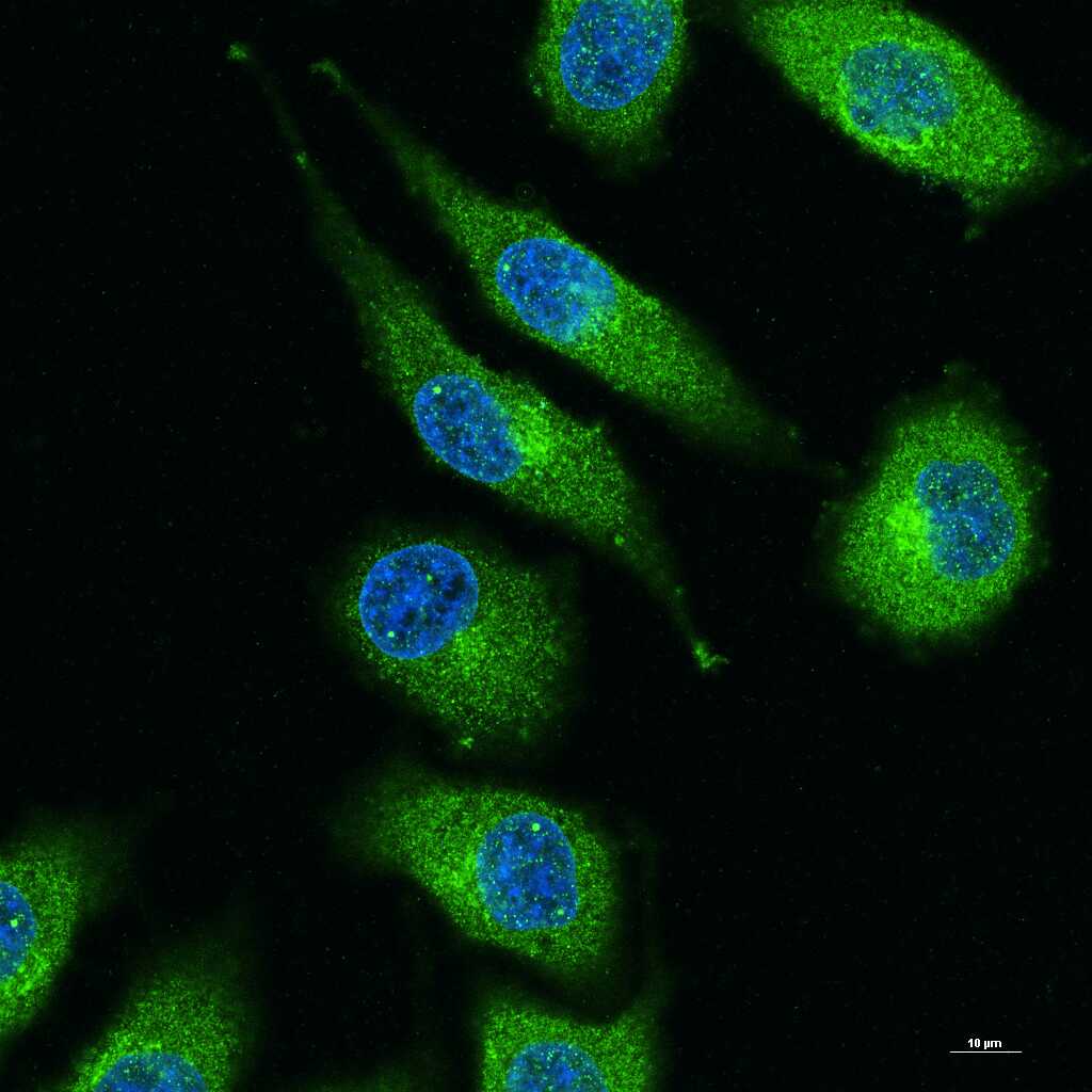 NFKB p65 Recombinant Rabbit mAb (一抗) - WB,IHC-P,IHC-F,IF,Flow-Cyt,ICC/IF | Bioss