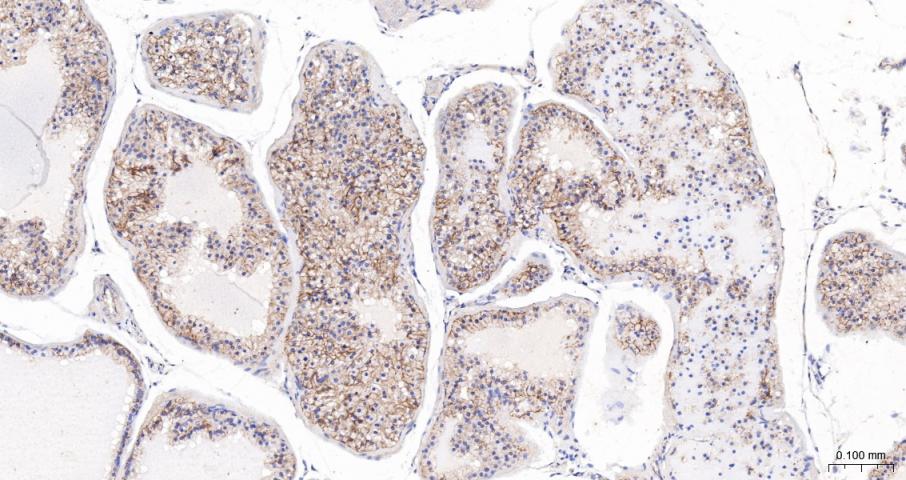 E cadherin Rabbit pAb (一抗) - IHC-P,IHC-F,IF | Bioss