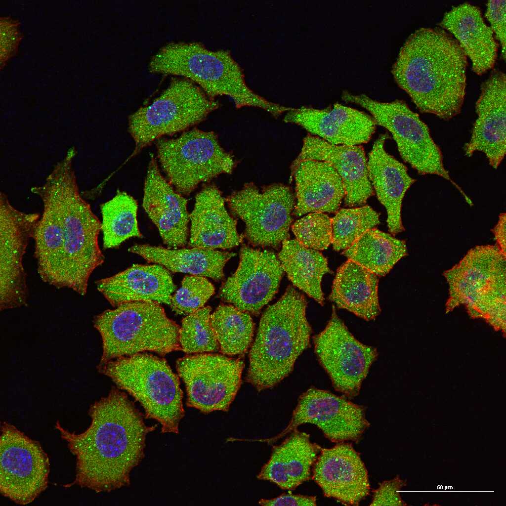 泛素结合蛋白P62重组兔单抗-bsm-60709R