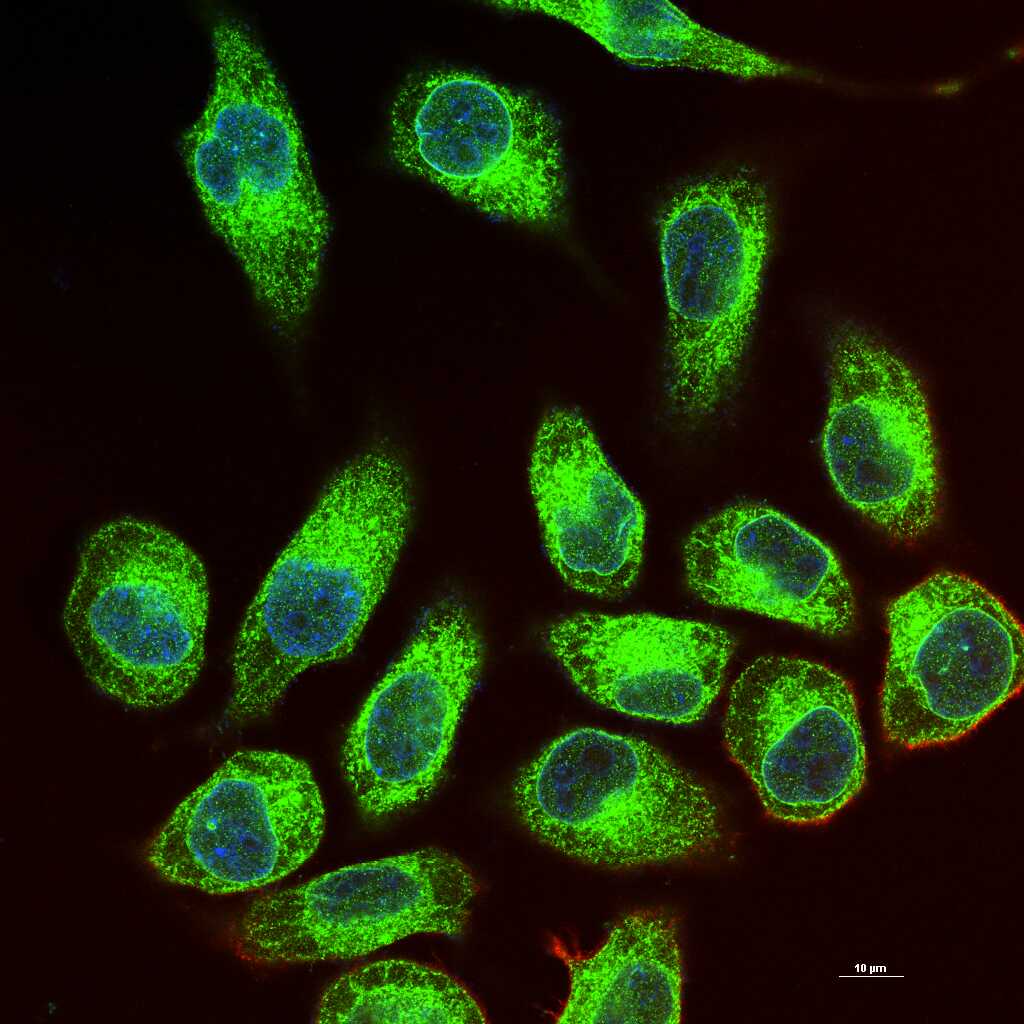 Calreticulin Recombinant Rabbit mAb (一抗) - WB,IHC-P,IHC-F,IF,Flow-Cyt,ICC/IF | Bioss