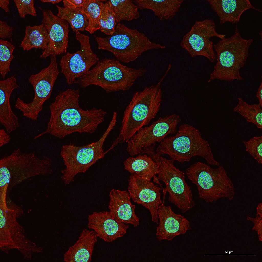 AKT1 Recombinant Rabbit mAb (一抗) - WB,IHC-P,IHC-F,IF,Flow-Cyt,ICC/IF | Bioss