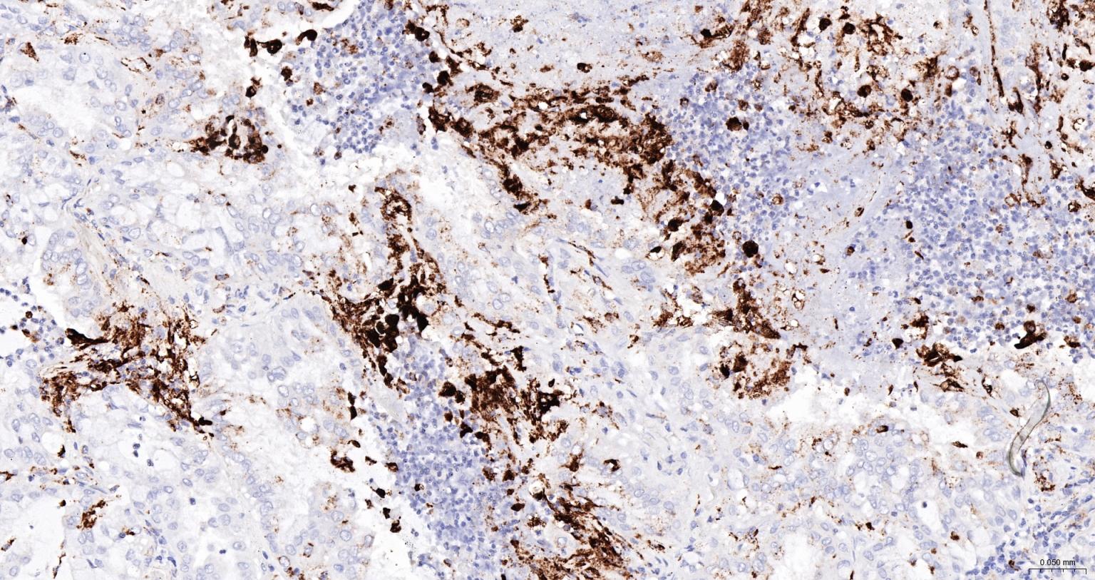 CD68 Mouse mAb (一抗) - IHC-P,IHC-F,IF | Bioss