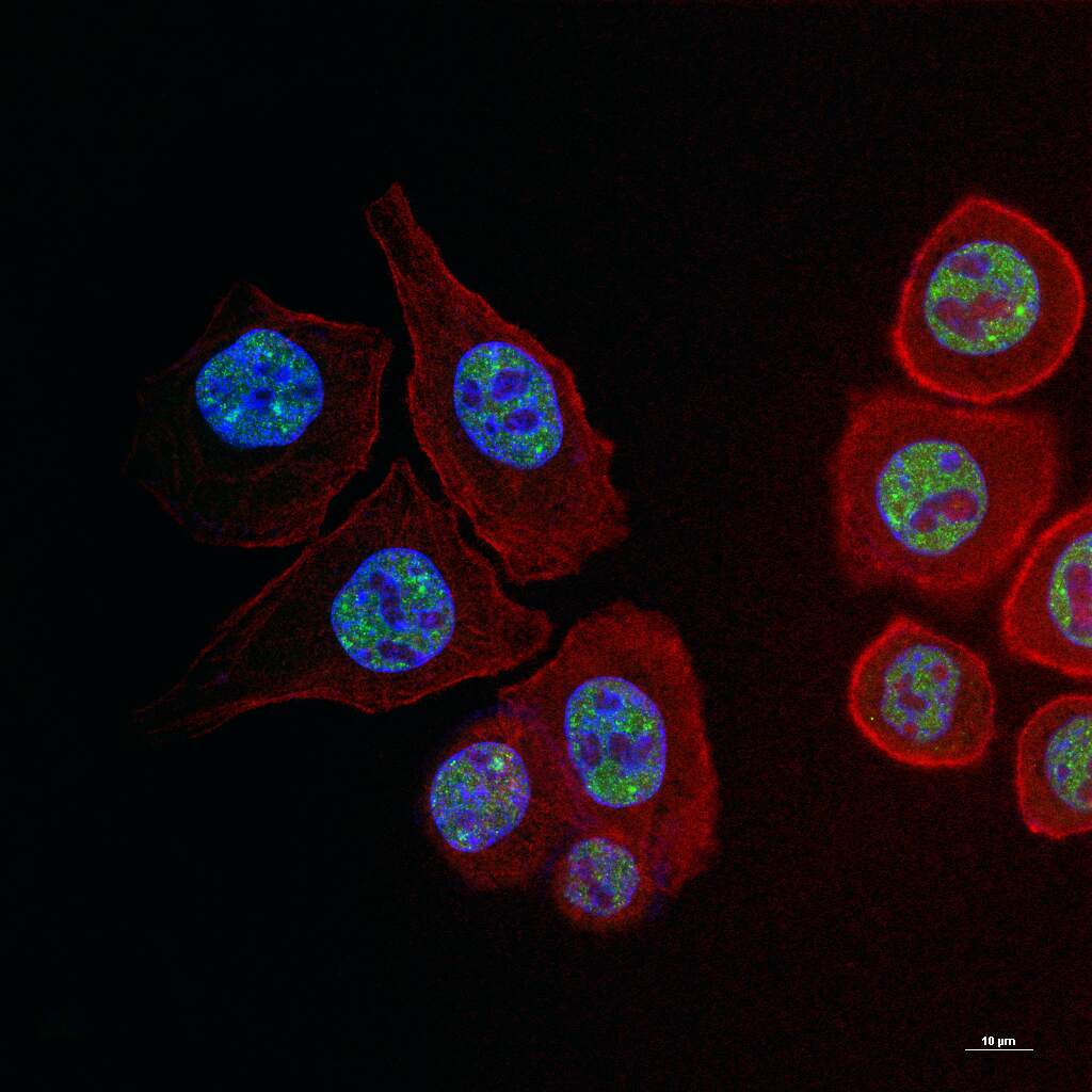 TDP-43 Recombinant Mouse mAb (一抗) - WB,IHC-P,IHC-F,IF,Flow-Cyt,ICC/IF | Bioss