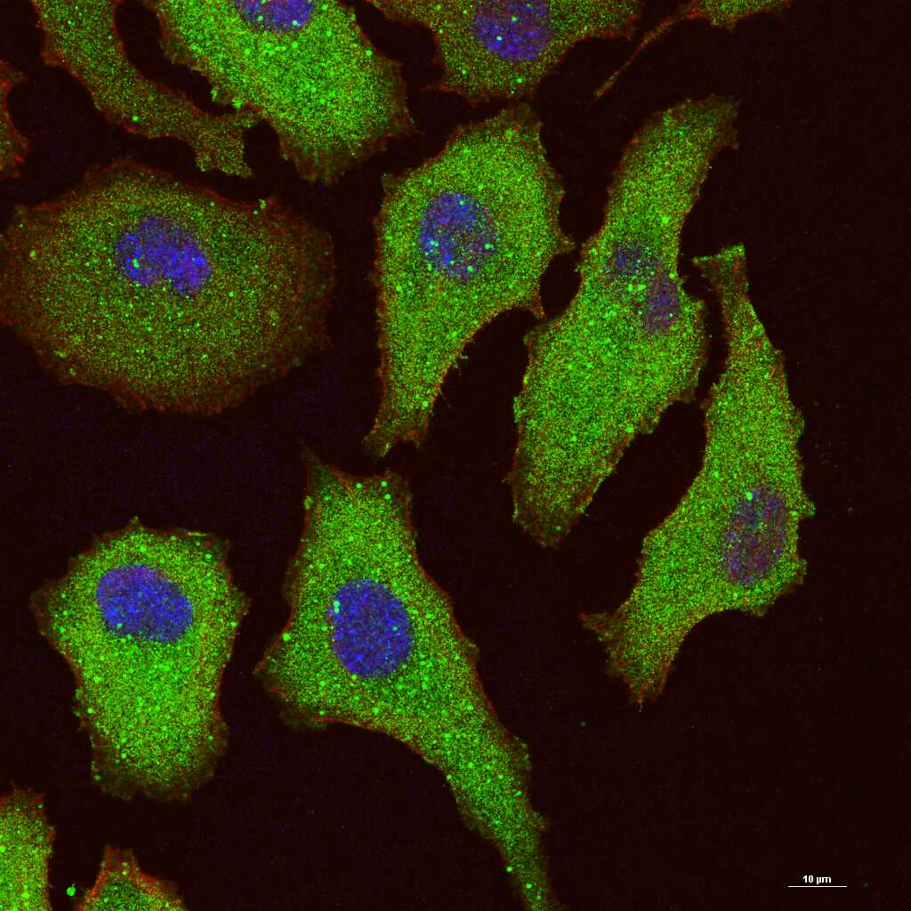 SQSTM1/p62 Recombinant Rabbit mAb (一抗) - WB,IHC-P,IHC-F,IF,Flow-Cyt,ICC/IF | Bioss