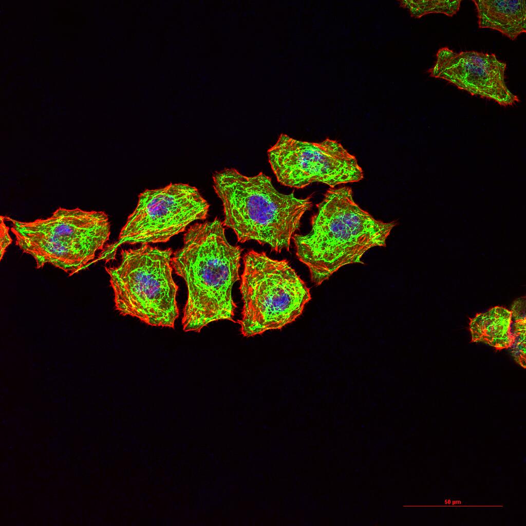 Cytokeratin 8 Recombinant Rabbit mAb (一抗) - WB,IHC-P,IHC-F,IF,ICC/IF | Bioss
