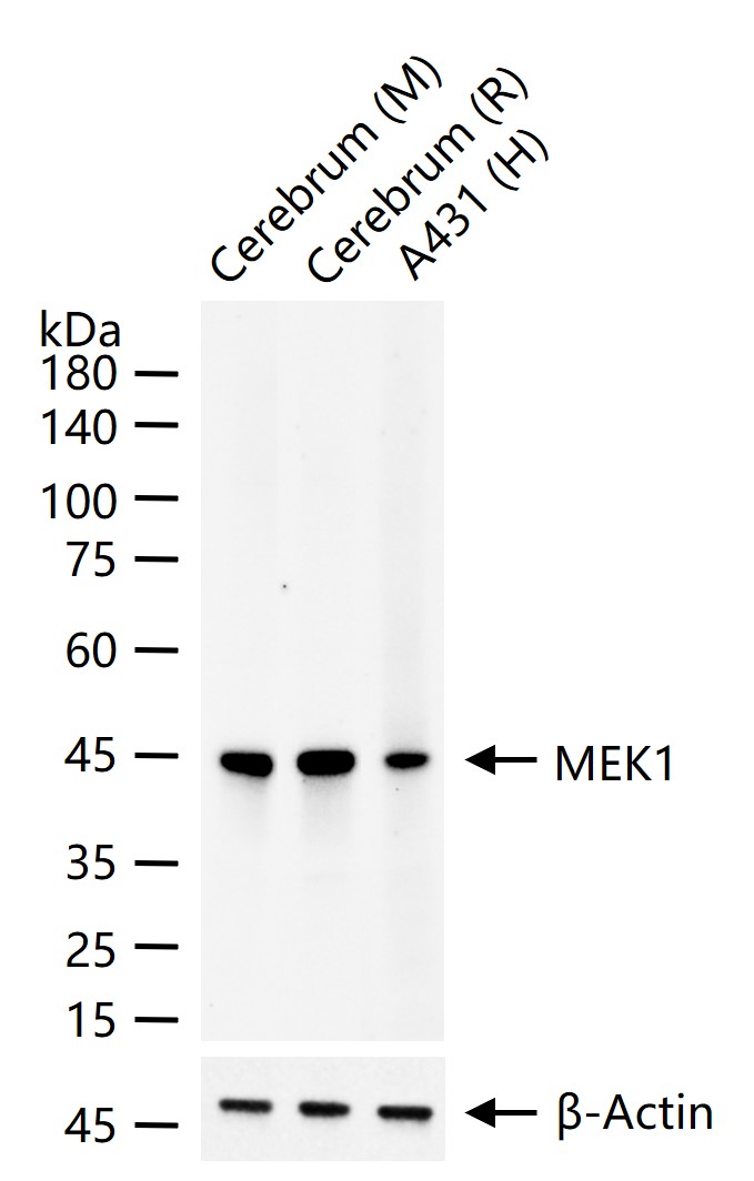 MEK1 Recombinant Rabbit mAb (一抗) - WB,IHC-P,IHC-F,IF,Flow-Cyt | Bioss