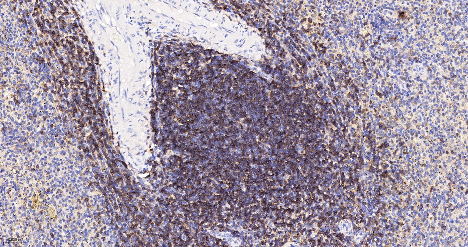 CD4重组兔单抗-bsm-52469R