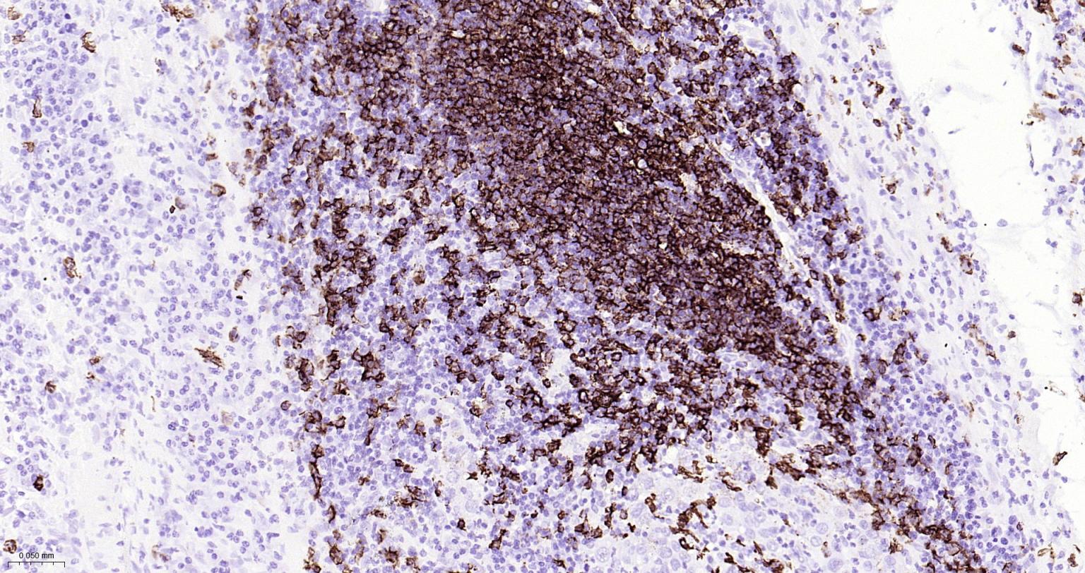 CD20重组兔单抗-bsm-63327R