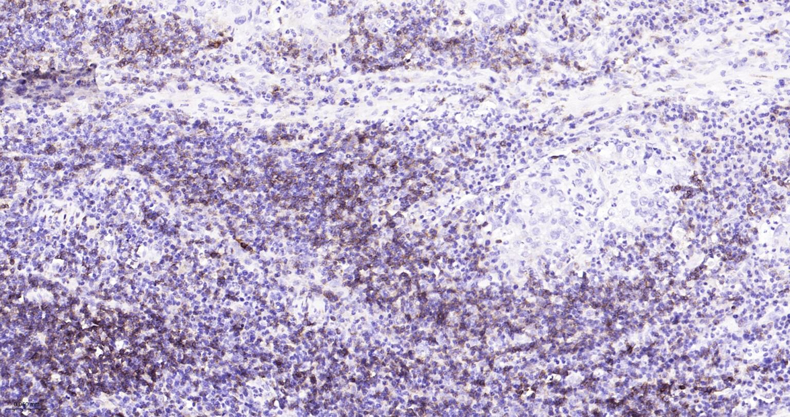 CD4重组兔单抗-bsm-52469R