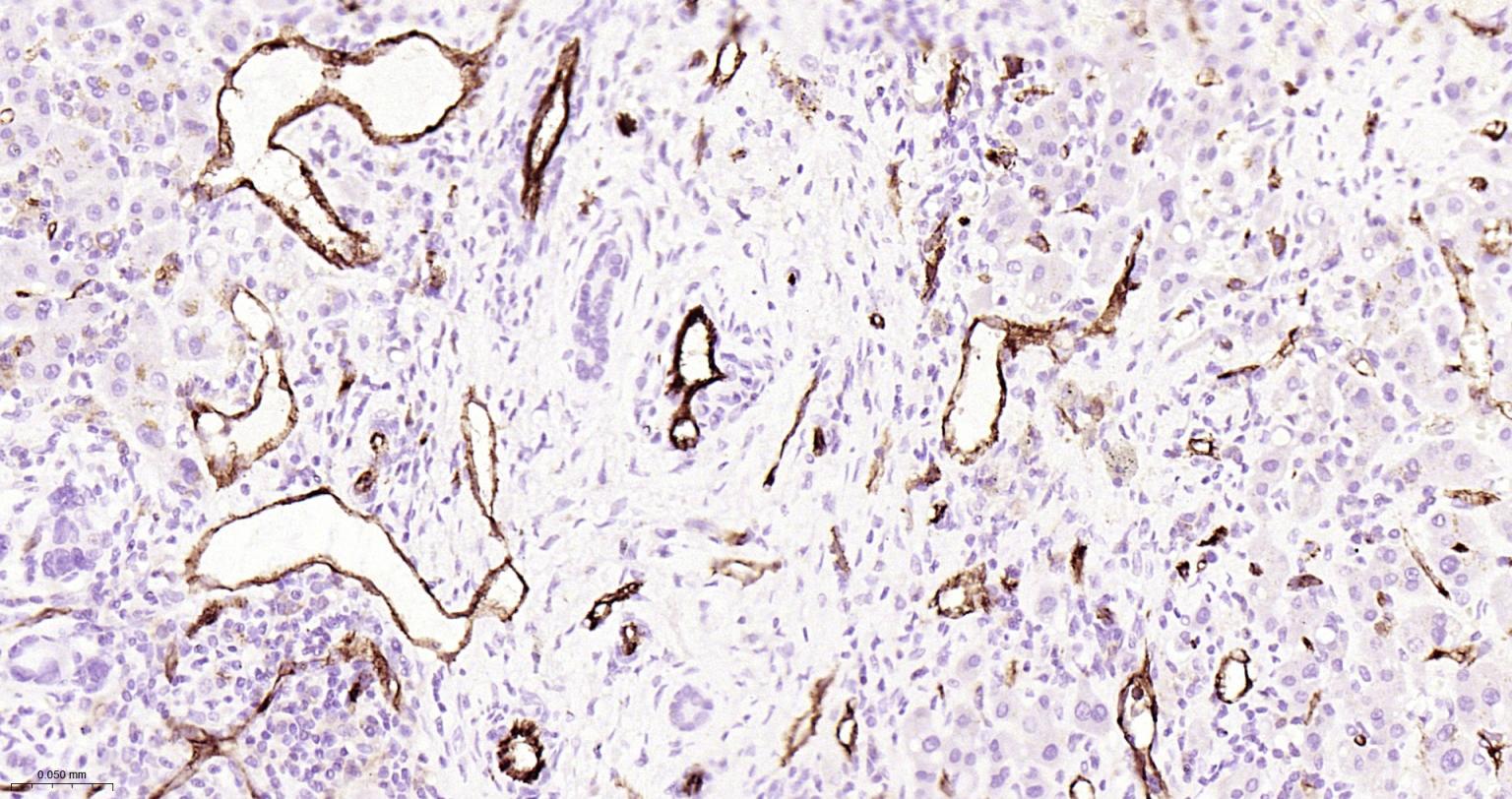 血小板内皮细胞黏附分子1单克隆抗体-bsm-10825M