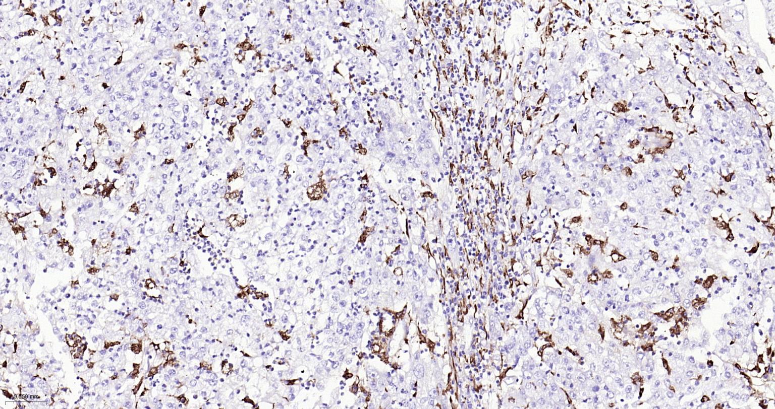 CD68重组兔单抗-bsm-60634R