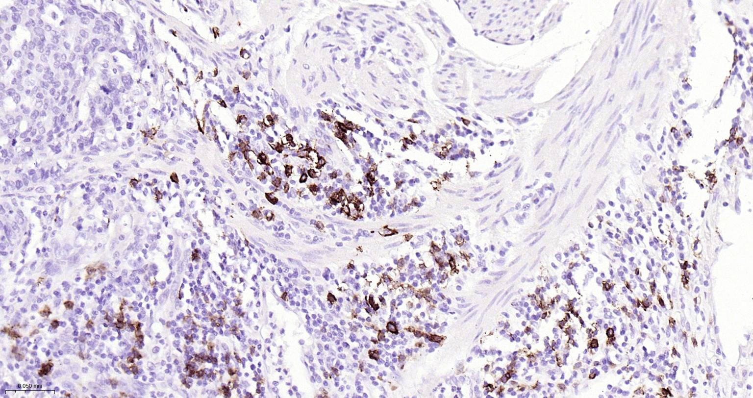 CD20重组兔单抗-bsm-63327R