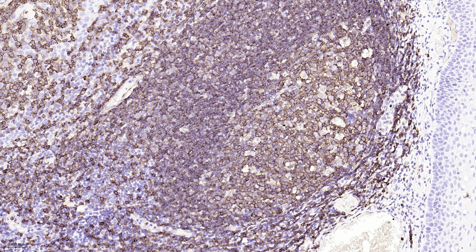 CD20重组兔单抗-bsm-63327R