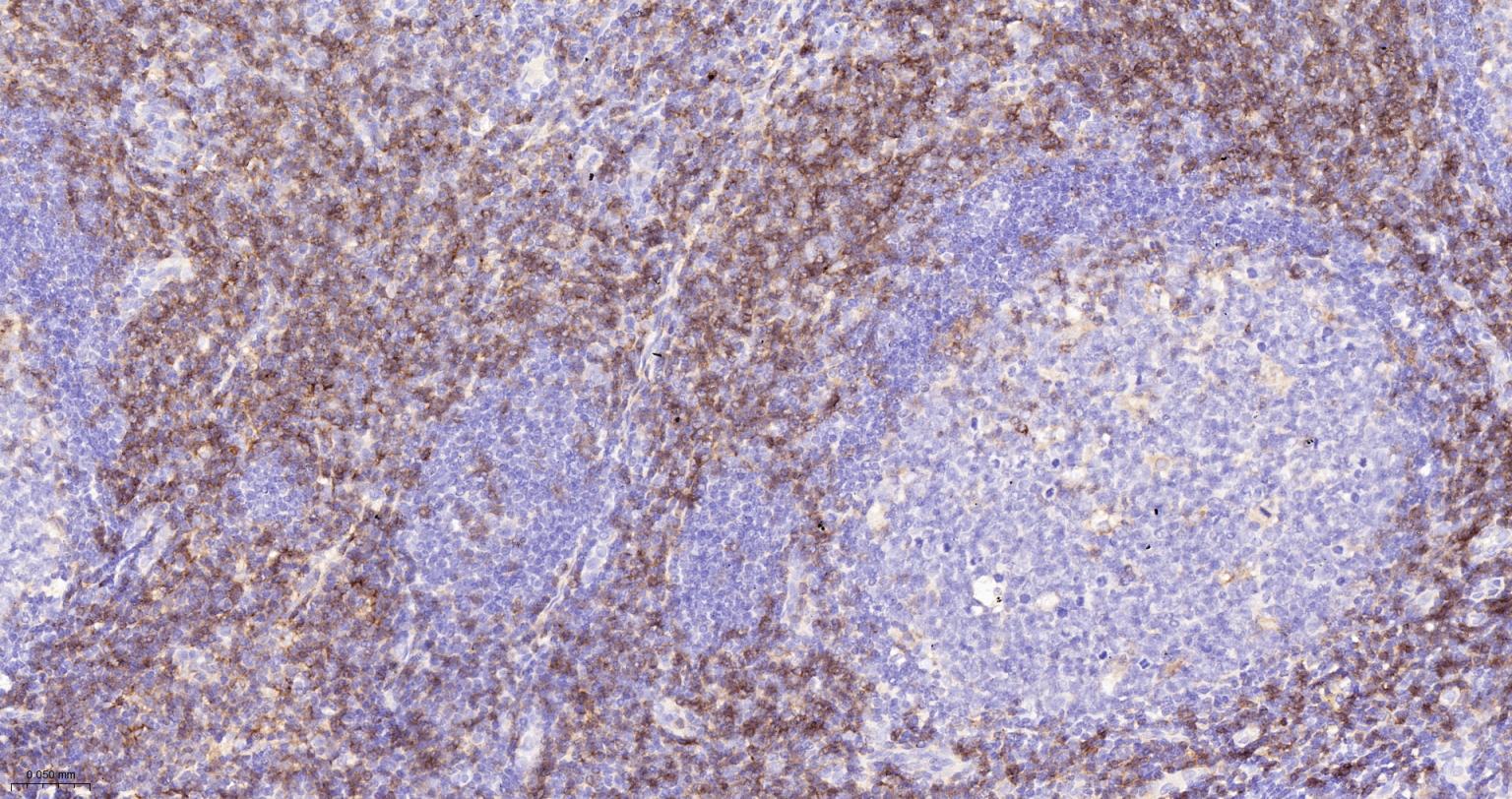 CD4重组兔单抗-bsm-52469R