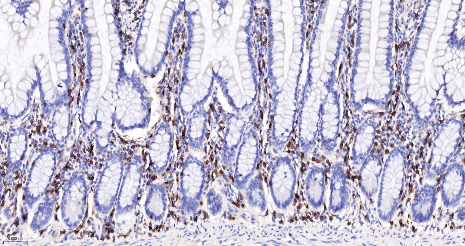 CD4重组兔单抗-bsm-52469R