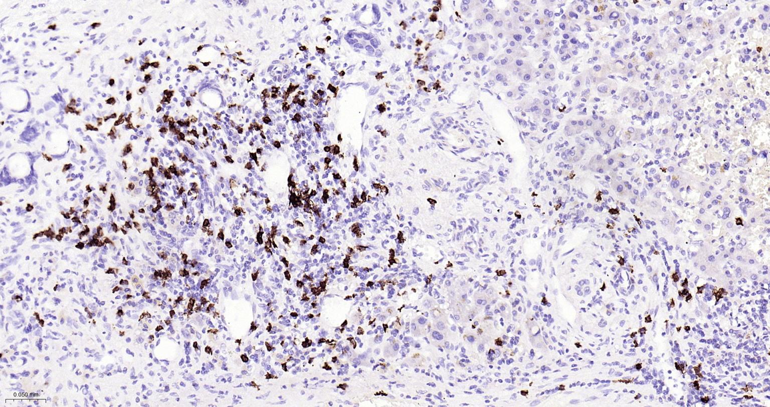 CD20重组兔单抗-bsm-63327R