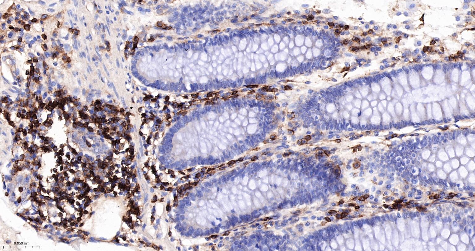 CD4重组兔单抗-bsm-52469R