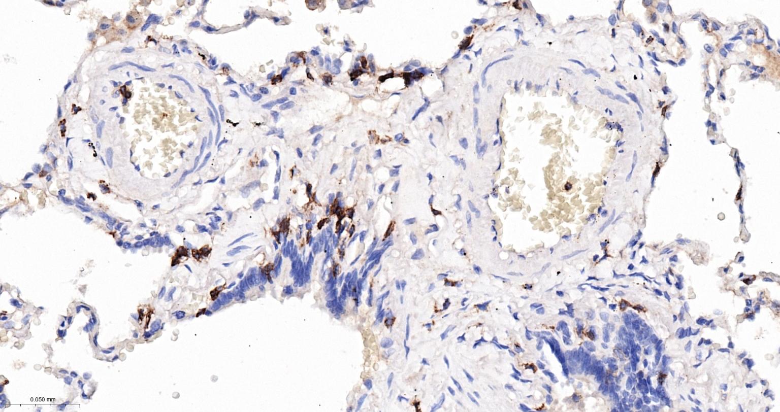 CD4重组兔单抗-bsm-52469R
