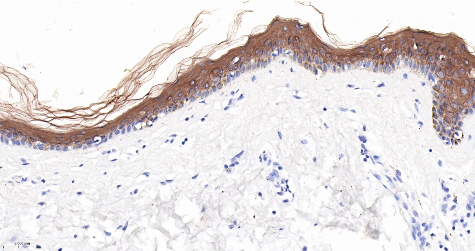 Cytokeratin 1 Mouse mAb (一抗) - IHC-P,IHC-F,IF | Bioss