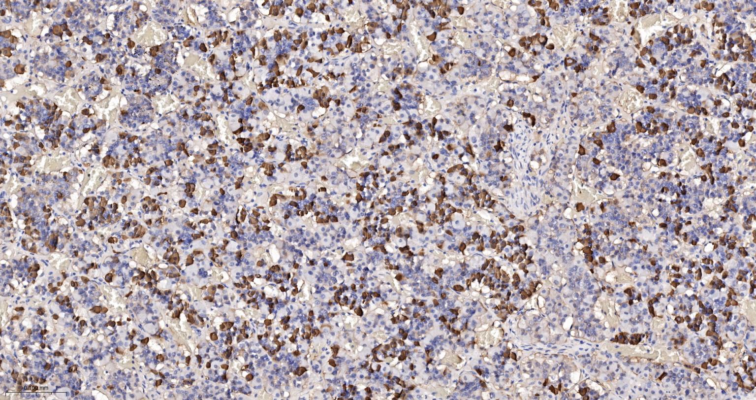 生长激素重组兔单抗-bsm-61438R