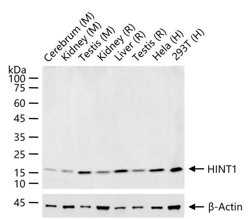 HINT1 Recombinant Rabbit mAb (一抗) - WB,IHC-P,IHC-F,IF | Bioss
