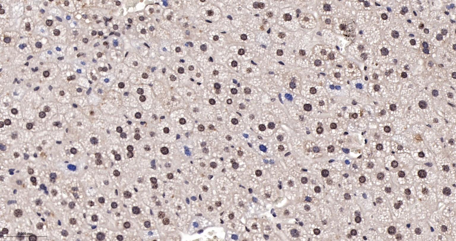 Glucocorticoid receptor Rabbit pAb (一抗) - IHC-P,IHC-F,IF,Flow-Cyt,ELISA | Bioss