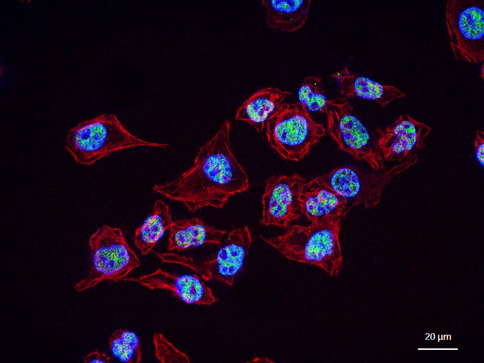 NRF1 Recombinant Rabbit mAb (一抗) - WB,IHC-P,IHC-F,IF,Flow-Cyt,ICC/IF | Bioss
