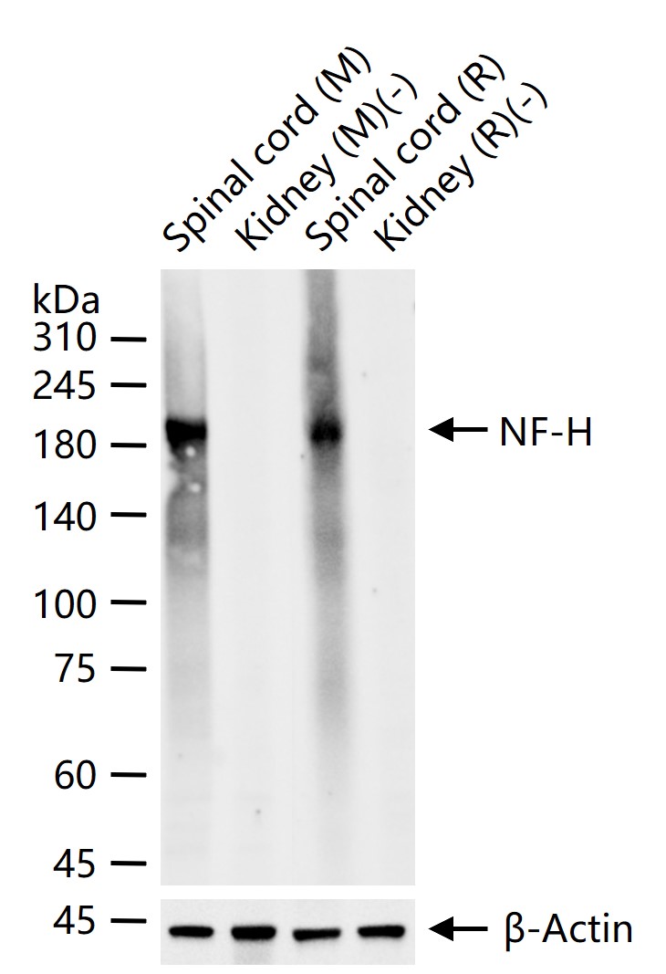 NF-H Recombinant Rabbit mAb (一抗) - WB,IHC-P,IHC-F,IF | Bioss