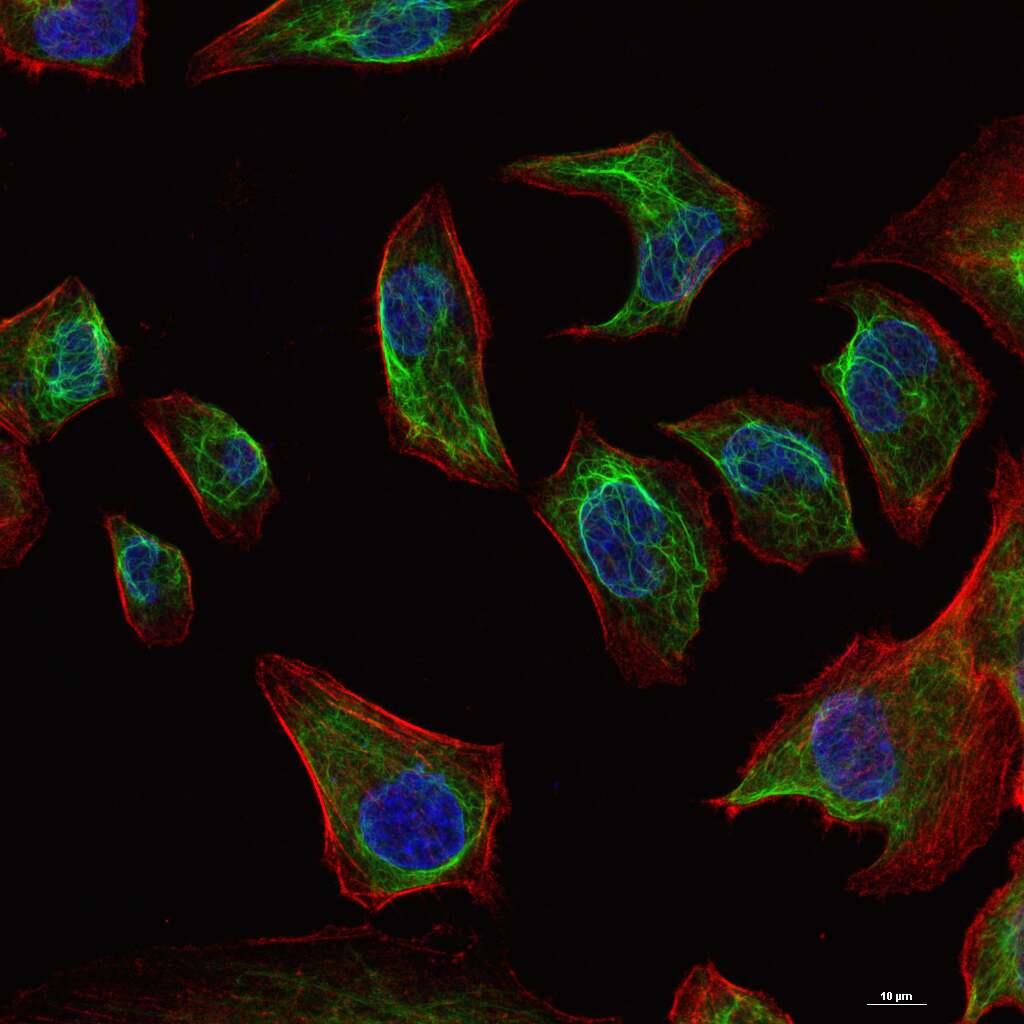Vimentin Mouse mAb (一抗) - WB,IHC-P,IHC-F,IF,Flow-Cyt,ICC/IF | Bioss