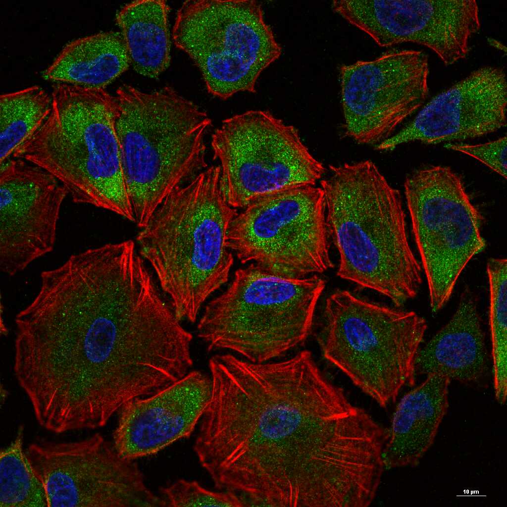 YB1 Recombinant Rabbit mAb (一抗) - WB,IHC-P,IHC-F,IF,Flow-Cyt,ICC/IF,IP | Bioss