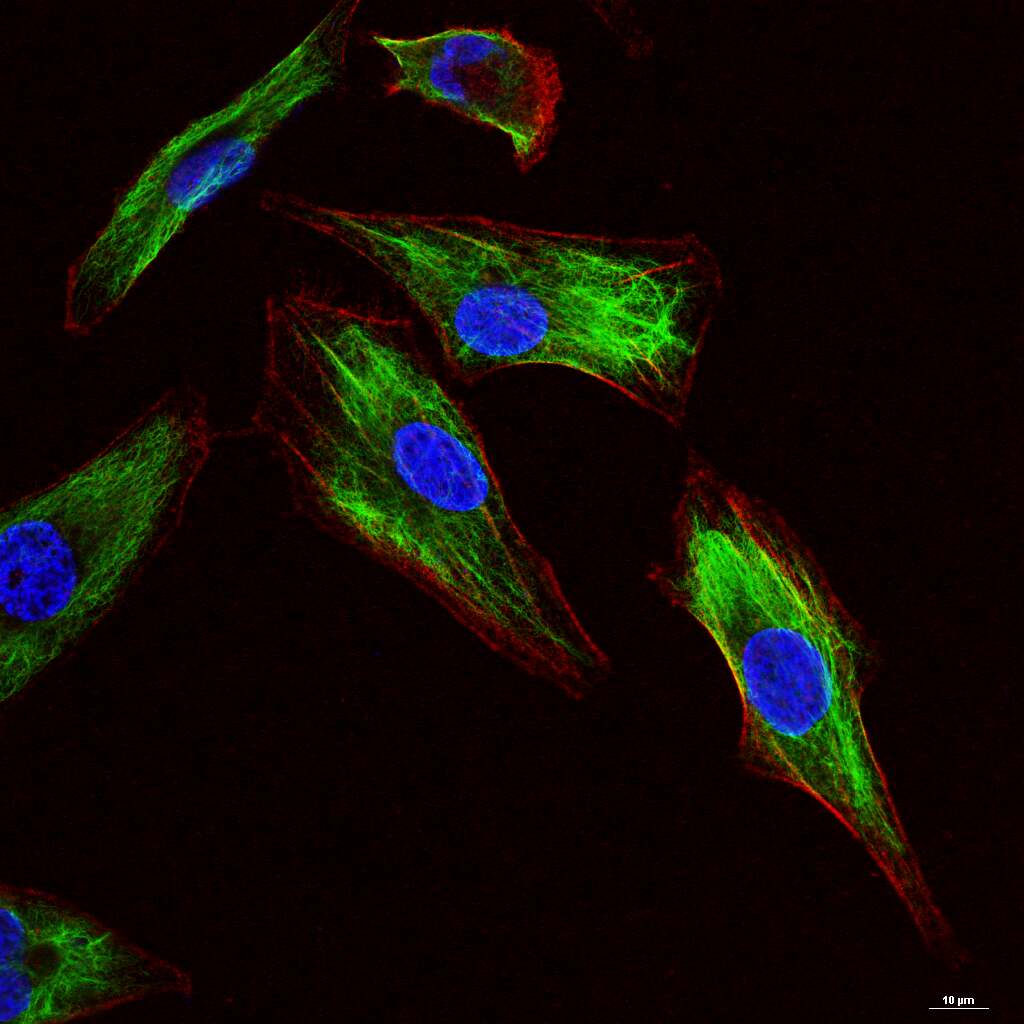 Vimentin Recombinant Rabbit mAb (一抗) - WB,IHC-P,IHC-F,IF,Flow-Cyt,ICC/IF | Bioss