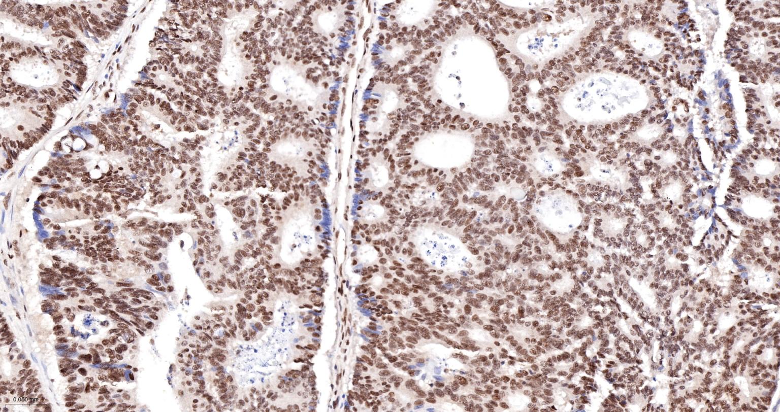 核转录调节因子YY1 (核内参)重组兔单抗-bsm-52349R