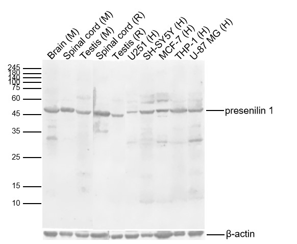 presenilin 1 Rabbit pAb (一抗) | Bioss