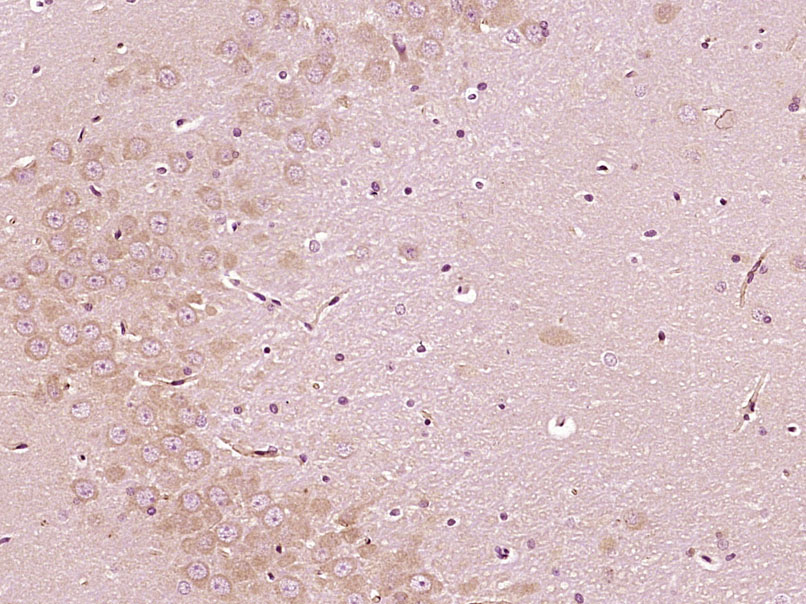 Bcl-2抗体-bs-0032R