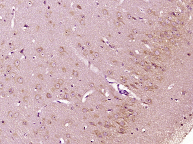 Bcl-2抗体-bs-0032R