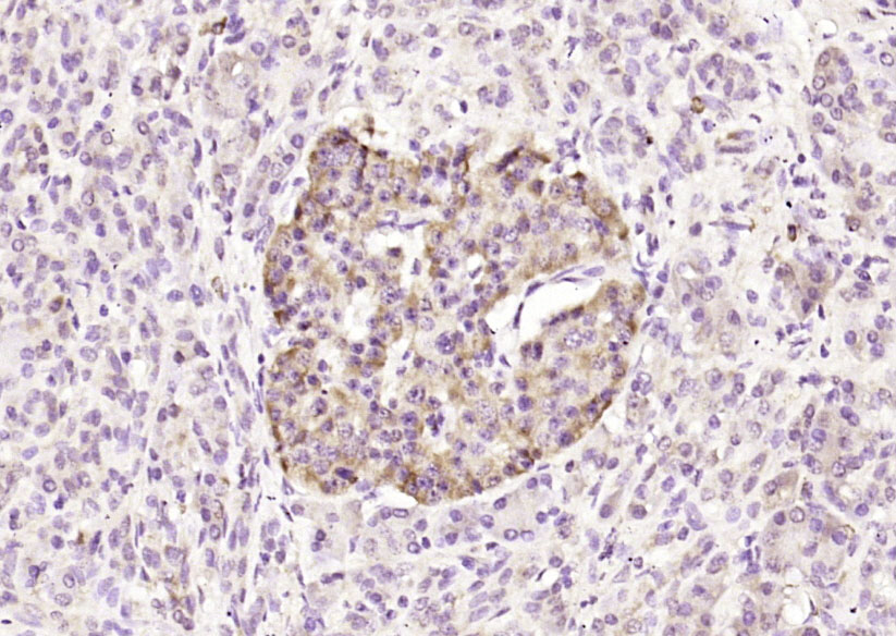 Bcl-2抗体-bs-0032R