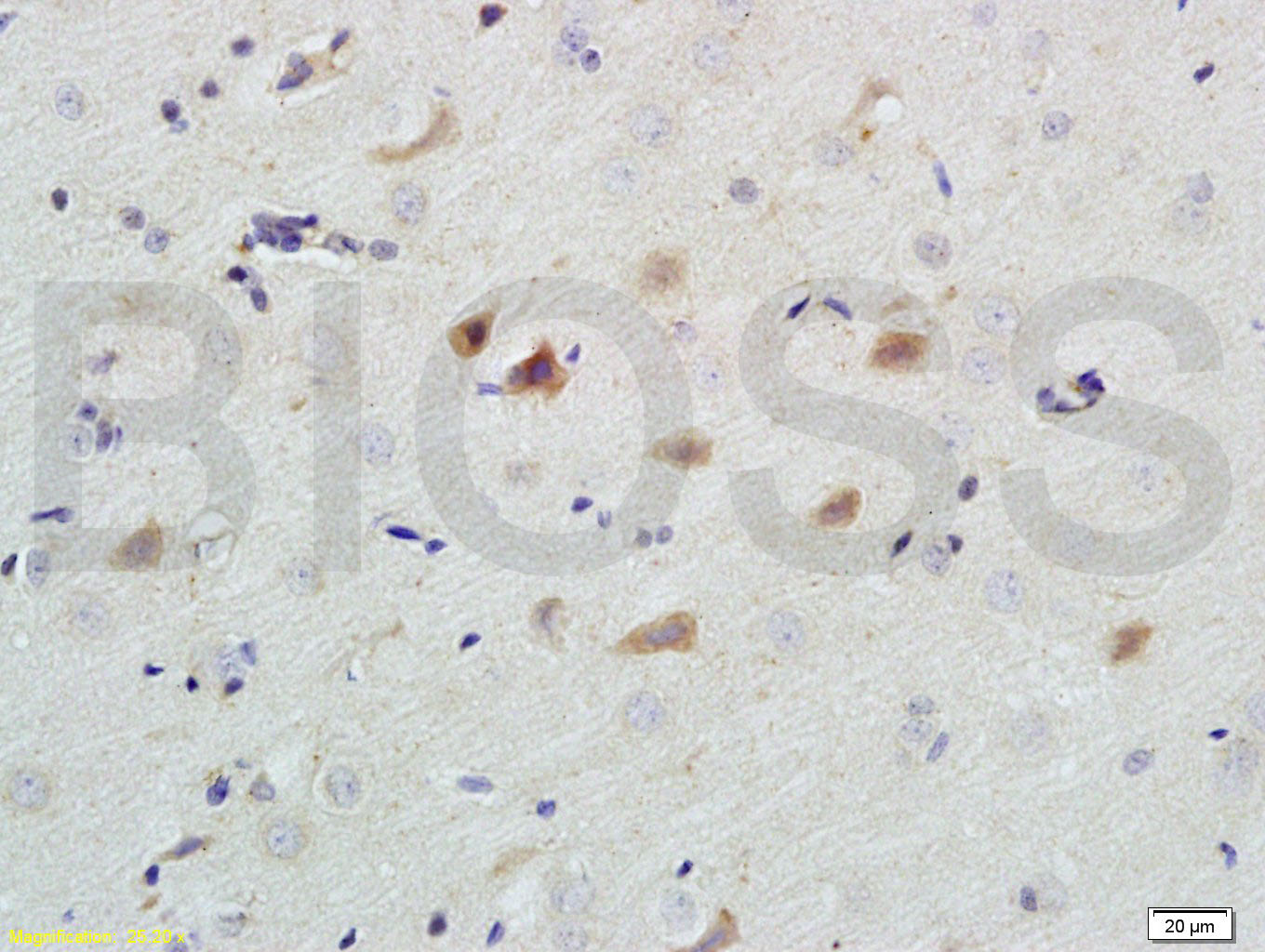 活化半胱胺酸蛋白酶蛋白-9抗体-bs-0049R