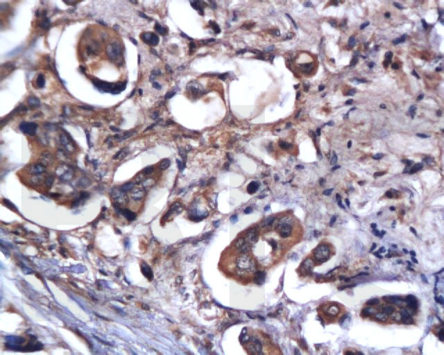 活化半胱胺酸蛋白酶蛋白-9抗体-bs-0049R