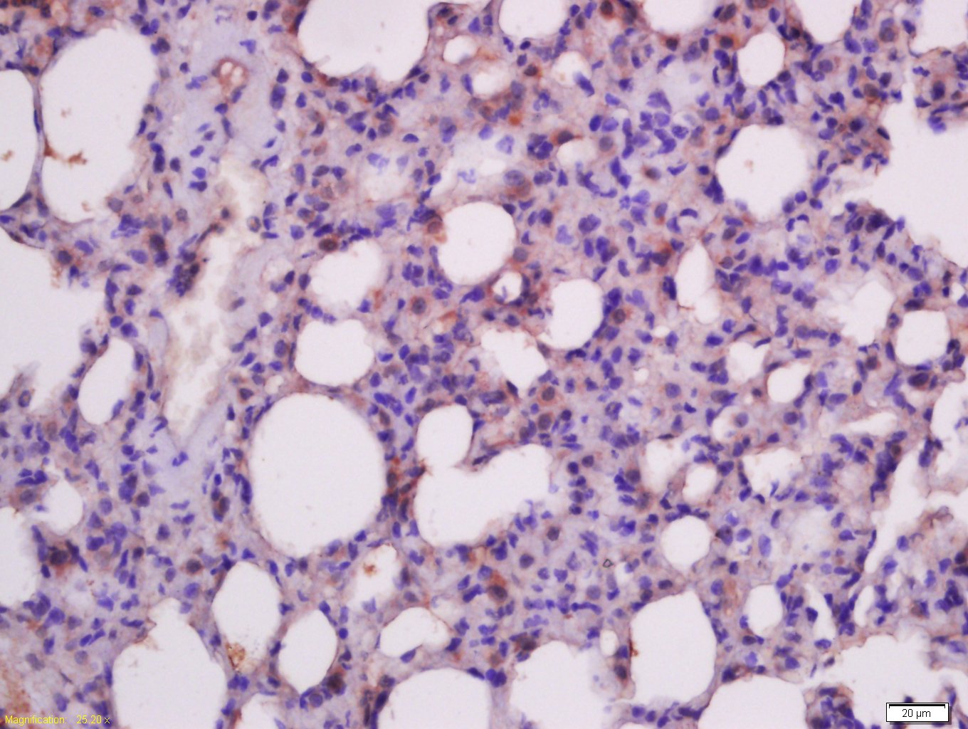 活化半胱胺酸蛋白酶蛋白-9抗体-bs-0049R