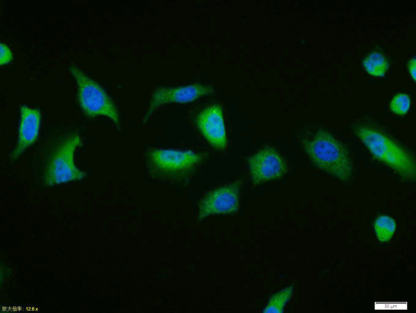 活化半胱胺酸蛋白酶蛋白-9抗体-bs-0049R