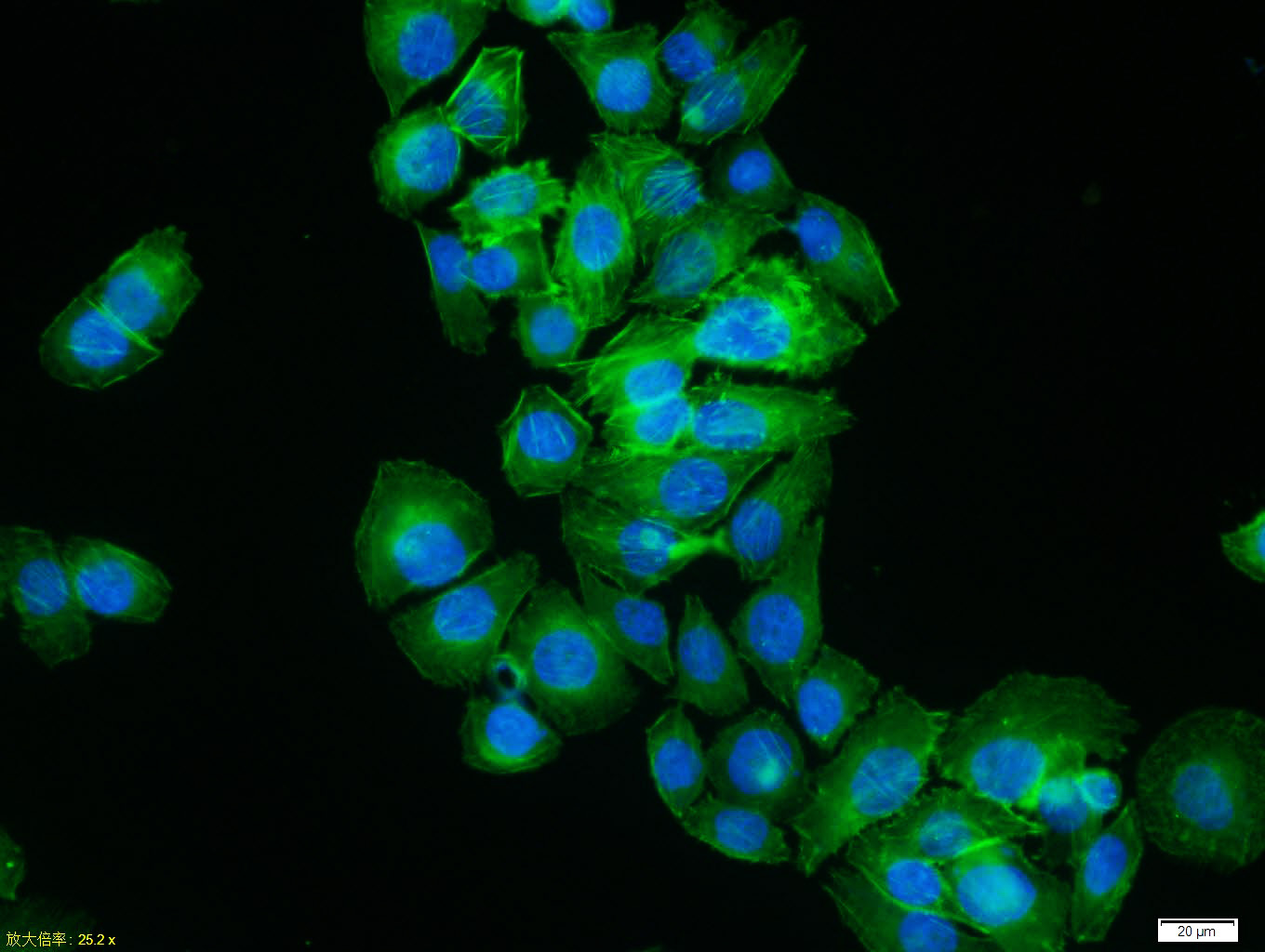 β-肌动蛋白/β-Actin(内参)抗体