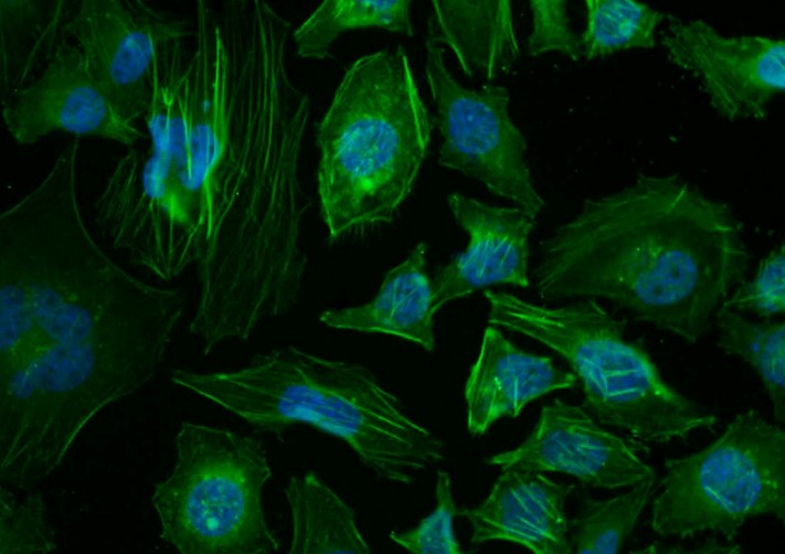 β-肌动蛋白/β-Actin(内参)抗体