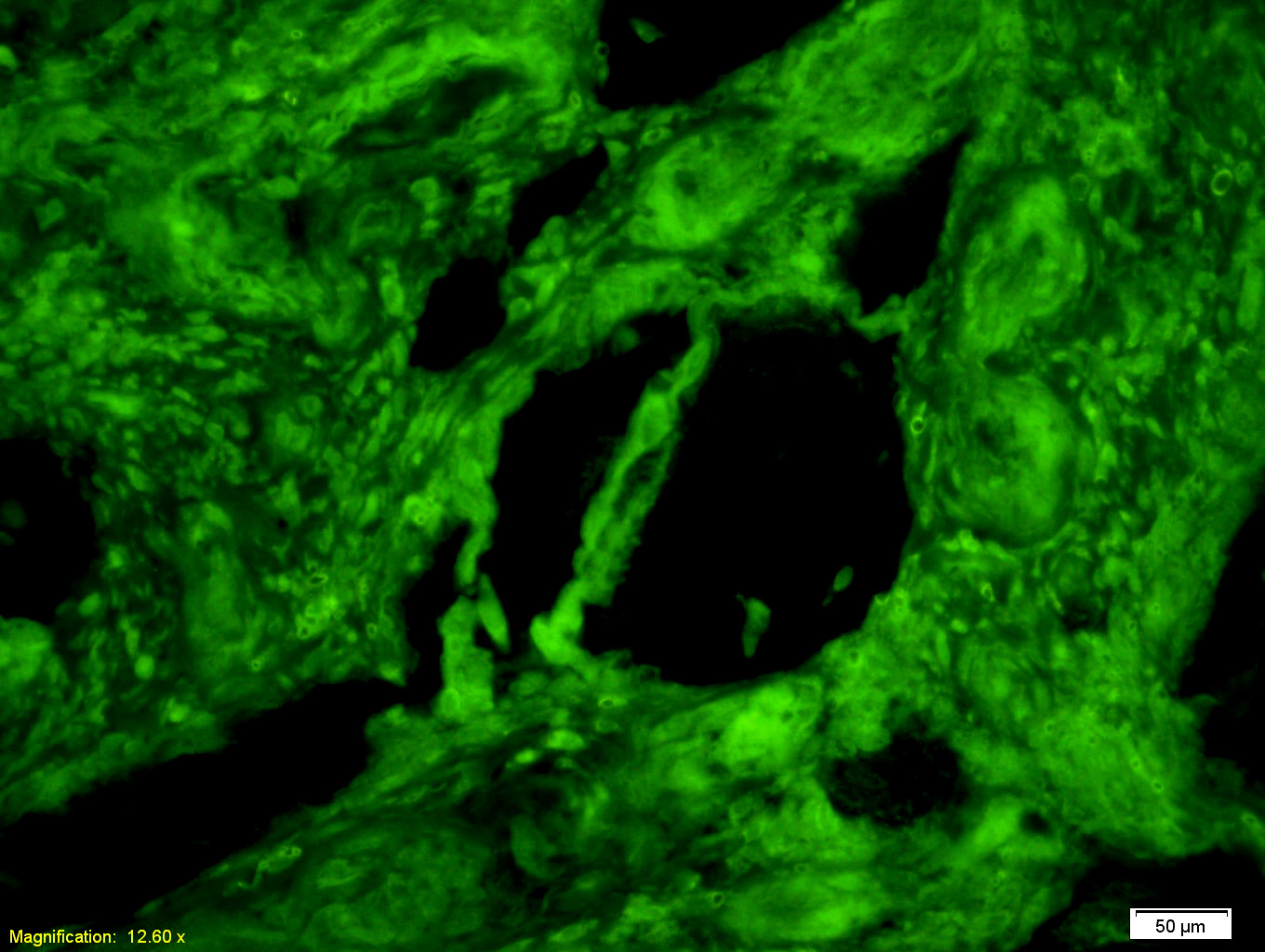 丙酮酸激酶-M2抗体