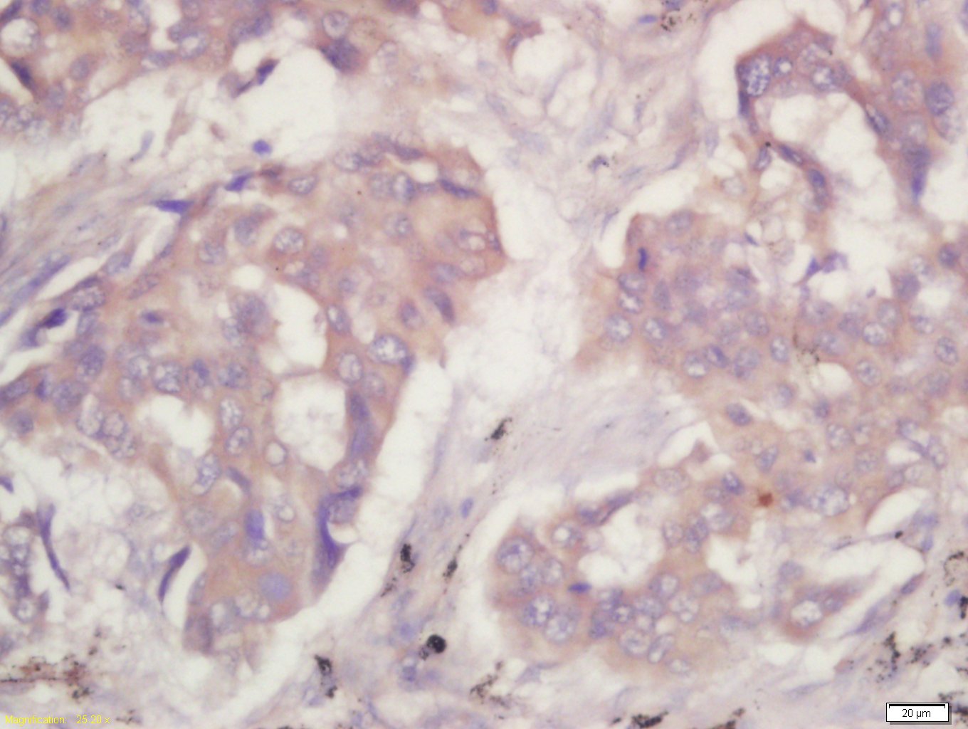 丙酮酸激酶-M2抗体